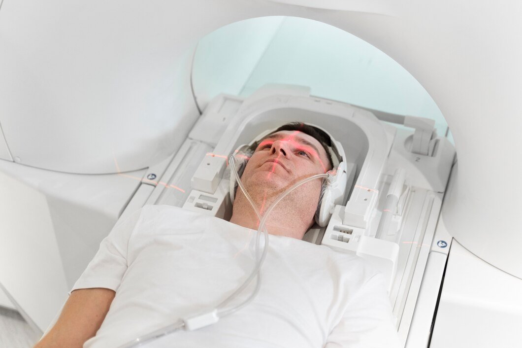 Intensity Modulated Radiotherapy (IMRT)