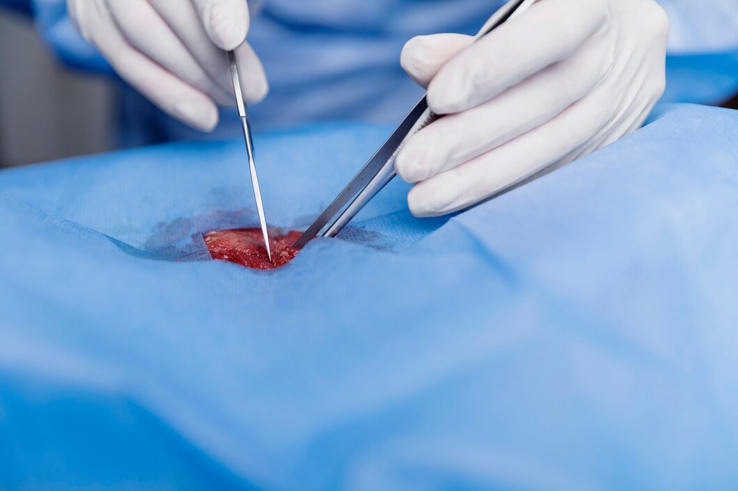 Laparoscopic Surgery