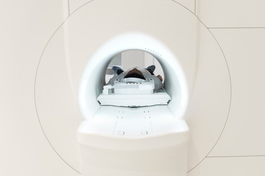 Stereotactic Radiotherapy (SRT)